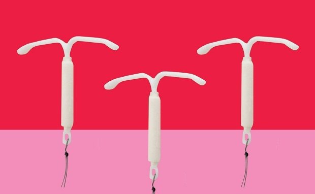 Vòng tránh thai IUD Marry